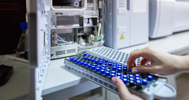 Laboratory scientist prepares samples for the High-performance Liquid Chromatograph Mass Spectrometer